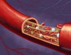 infrarood en de bloedcirculatie